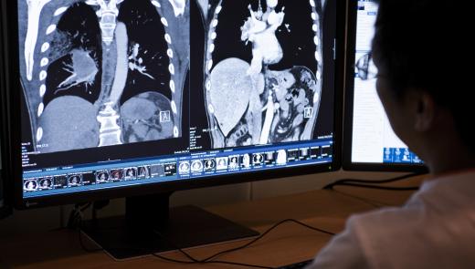 Radiologische beelden